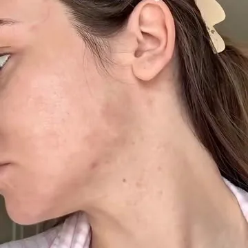 Instagram post by The Elixir Clinic, 10.03.2026